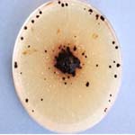 Young culture of Rhizoctonia solani
